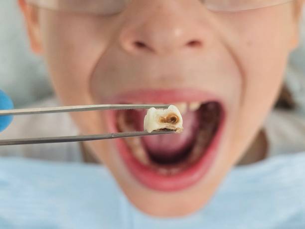 Best Pediatric Emergency Dentist in Plafield, IN